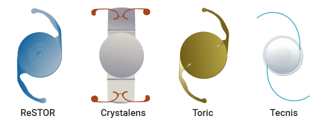 Examples of Lenses for Cataract Surgery - ReSTOR - Crystalens - Toric - Tecnis